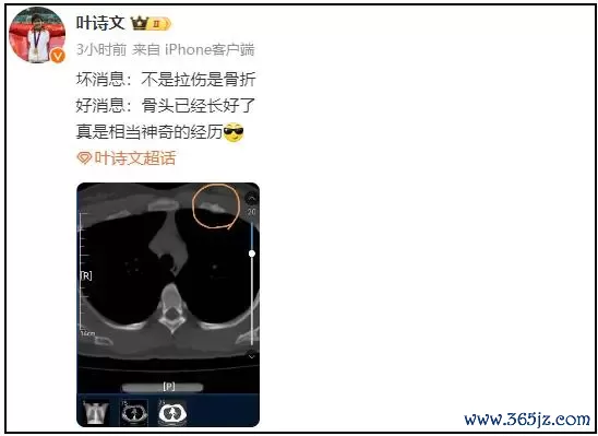 叶诗文今晚发文：不是拉伤是骨折